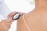 Skin Cancerjpg