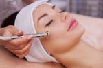 dermabrasion