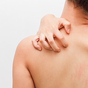 Skin Growths