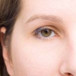 undereye